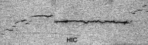 HIC 